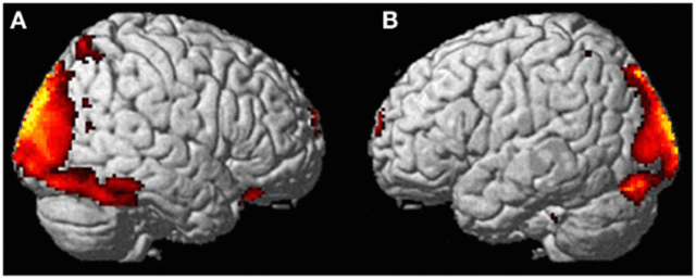 Scientists Scanned A Woman's Brain-5649f42d4a36cbfe88dc34614841d