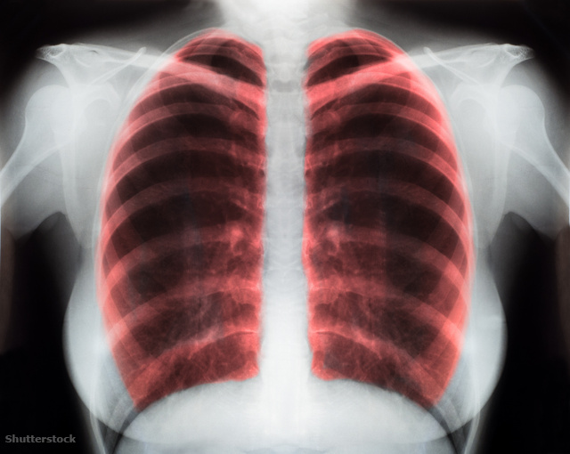 mit kell inni asztmás hipertónia esetén