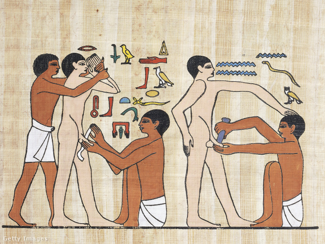 Az ókori Egyiptomban már orvosi csodákra voltak képesek
