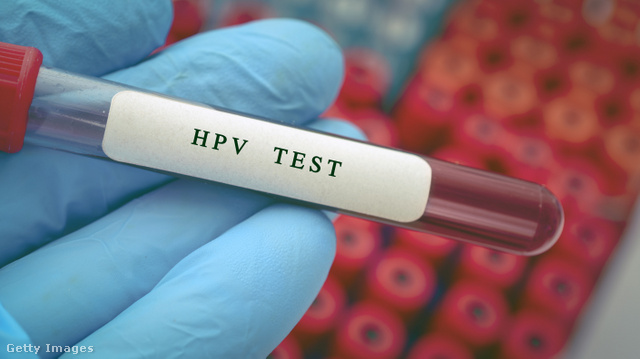 A férfiaknál is rákos megbetegedést okozhat a HPV
