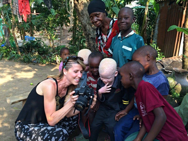 Afrikai utazása során a tanzániai albínókhoz is ellátogatott