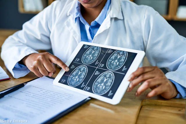 Az MRI-vizsgálatok kimutatták: az internet káros az agyra
