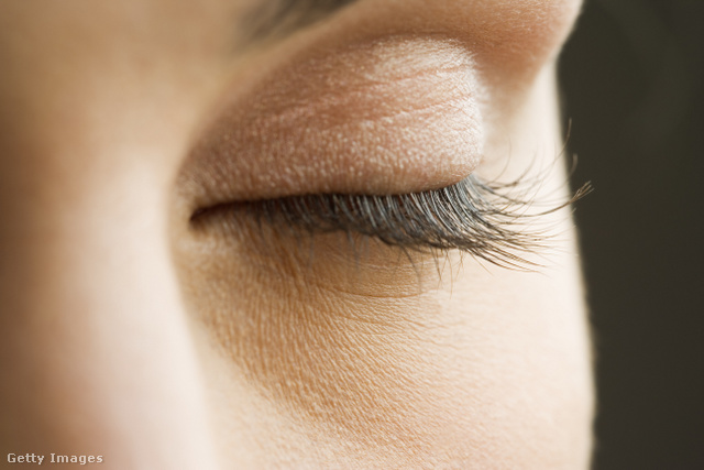 A szem szőrzetének hullása nem feltétlenül jelez betegséget