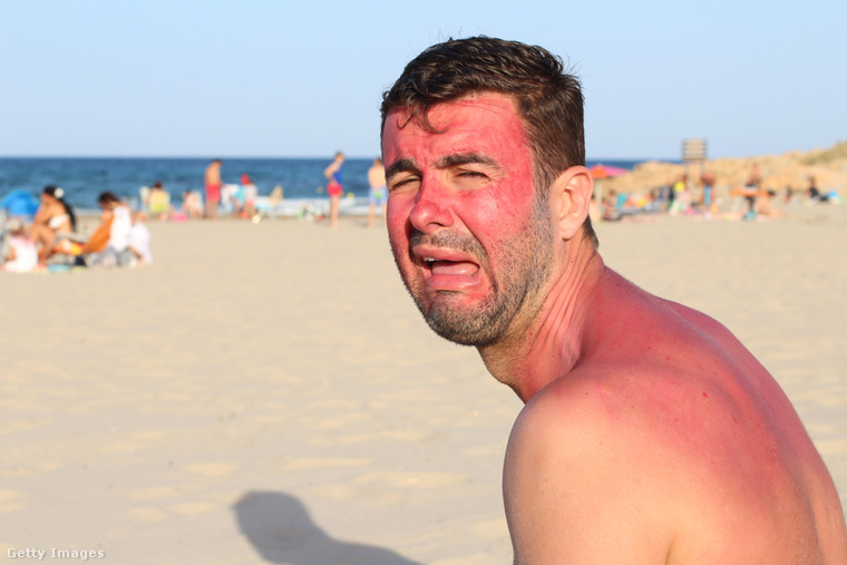 A leégés nagyon káros a bőrnek. (Fotó: ajr_images / Getty Images Hungary)