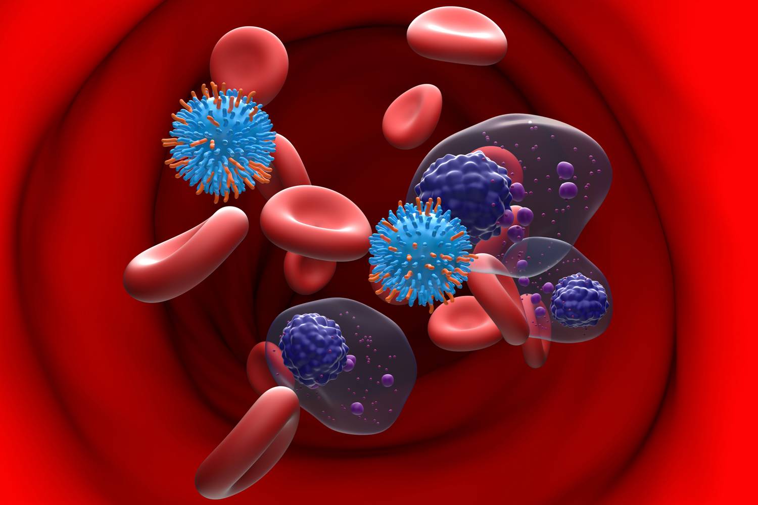 Plazmasejtes daganat myeloma multiplex tünetei 1