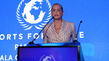 Sharon Stone sokkoló monoklis képe: „Senki nem bántott”