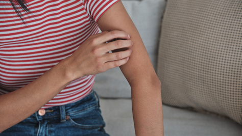 Mi csípett meg éjszaka? Mutatjuk, hogy néz ki az ágyi poloska csípése