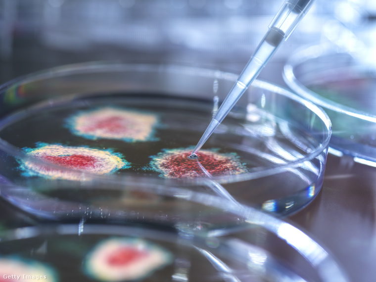 Azonban nem csak a vírusok, hanem bizonyos baktériumok is növelhetik a rák kialakulásának esélyét. (Fotó: Tek Image/science Photo Library / Getty Images Hungary)