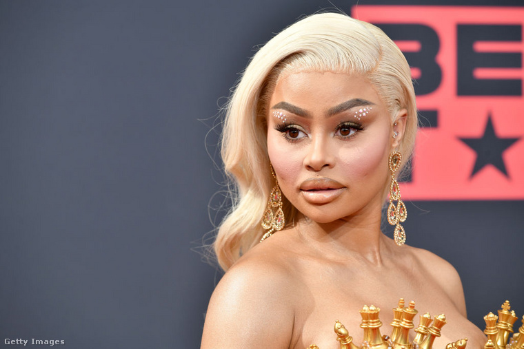 Blac Chyna: 36,4 millió forintos ajándék plasztika Blac Chyna egykori párja, Rob Kardashian az Instagramon azt állította, hogy több mint 100 ezer dollárt (kb