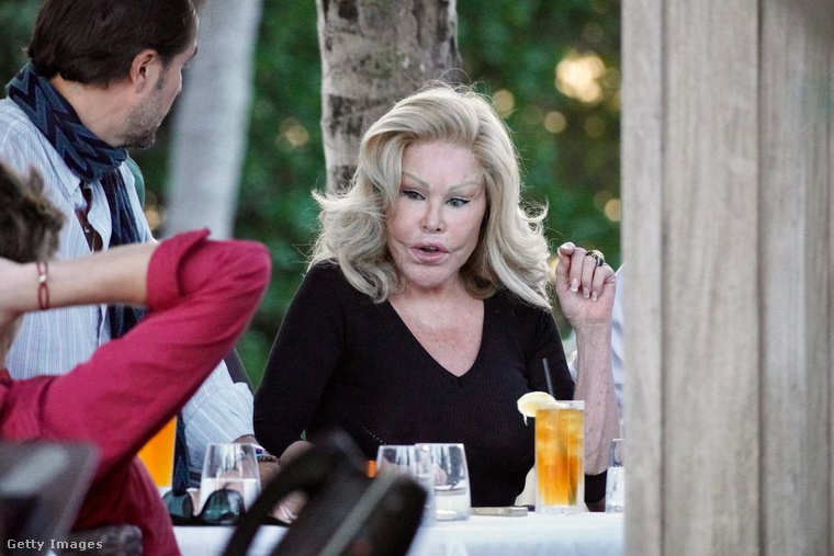 Jocelyn Wildenstein: a „Macskanő” több mint 2,35 milliárd forintot költött műtétekre&nbsp;Jocelyn Wildenstein az extrém műtétei miatt kapta a „Macskanő” becenevet