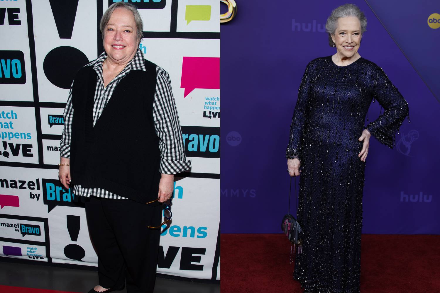 Kathy Bates 2014-ben és 2024-ben. Durva a különbség a két kép között.