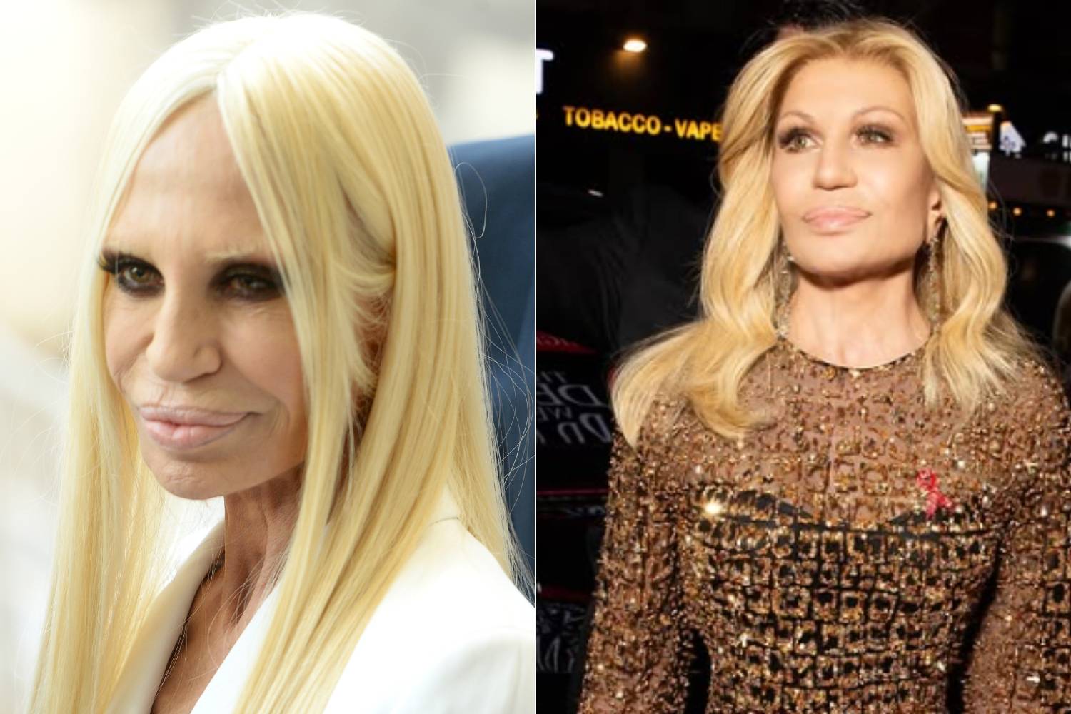 Donatella Versace tíz évvel ezelőtt és a múlt héten. Bár a másik képen van némi retusálás, így is óriási a különbség.