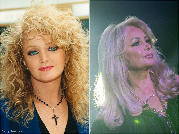 Bonnie Tyler 73 évesen is megőrizte fiatalos vonásait.