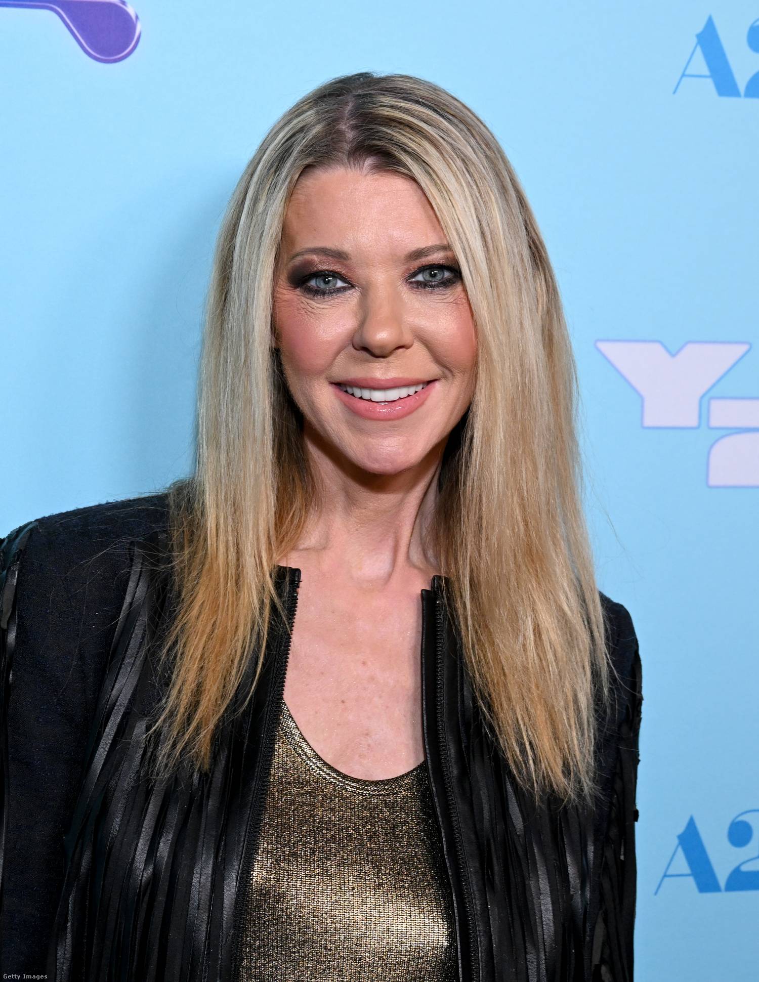 Tara Reid arca rengeteget változott a plasztikai beavatkozások következtében, egykori babaarca nemcsak az idő múlása miatt lett a múlté, a műtétek miatt is idősebbnek tűnik koránál.