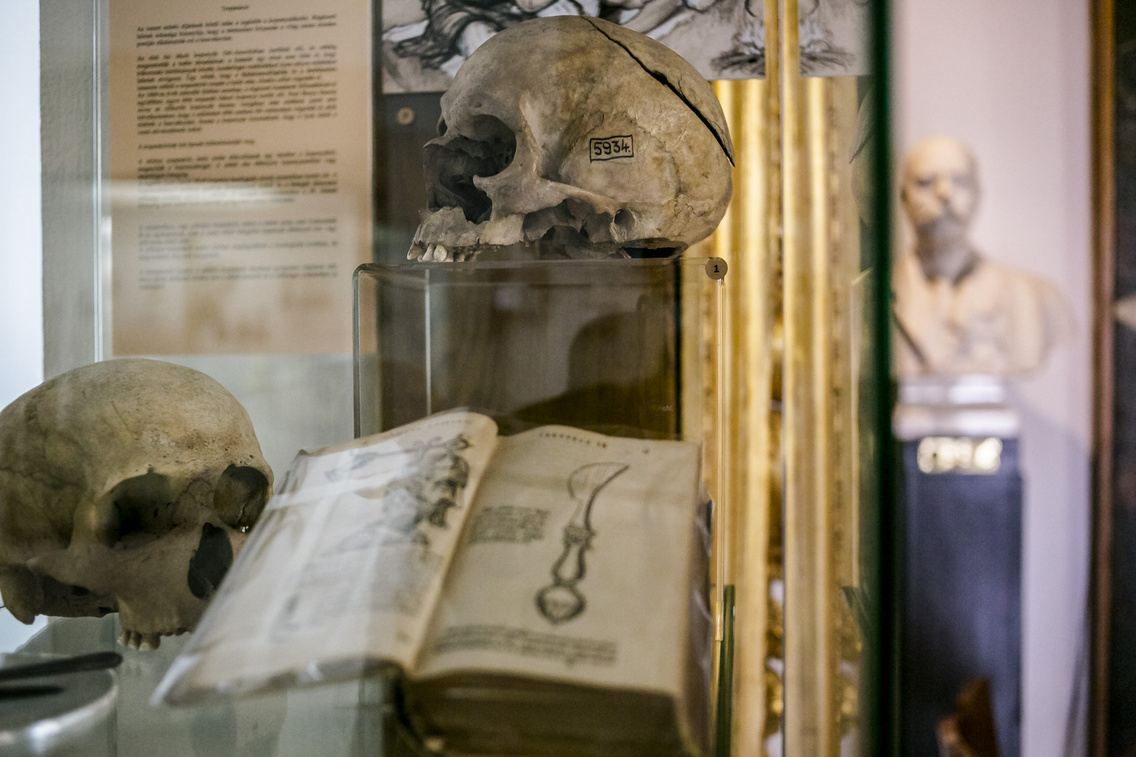semmelweis-orvostorteneti-muzeum hartyanyi-norbert 20161130