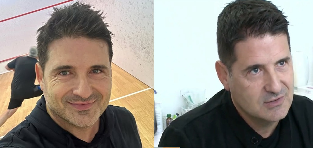 Hajdú Péter botox előtt és után