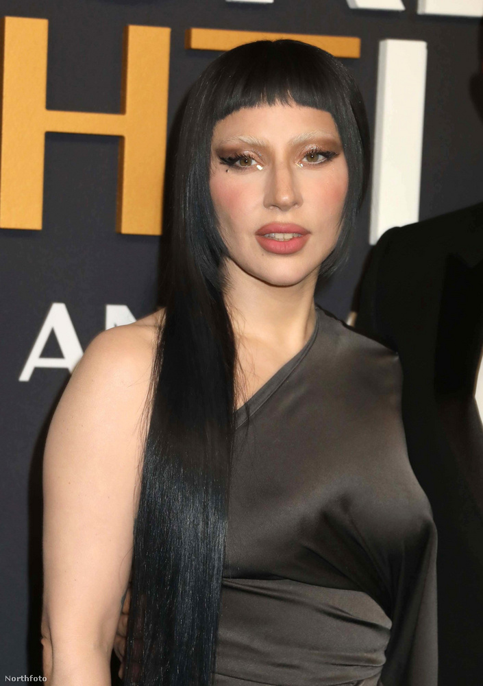 Lady Gaga korábban már beszélt róla, hogy mennyire rosszul érintette, amikor realizálta, hogy egy pop ikonná nőtte ki magát