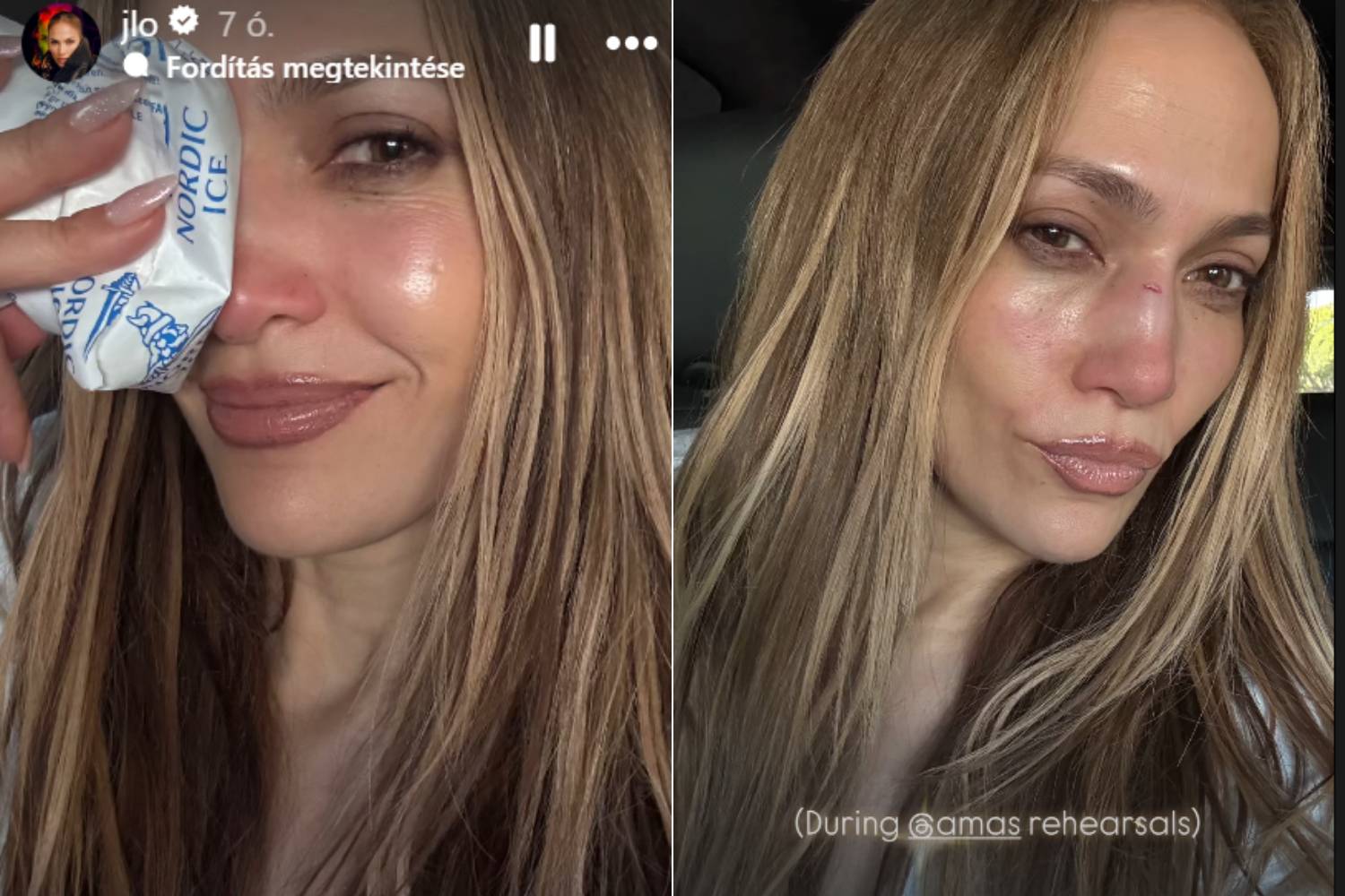 jlo