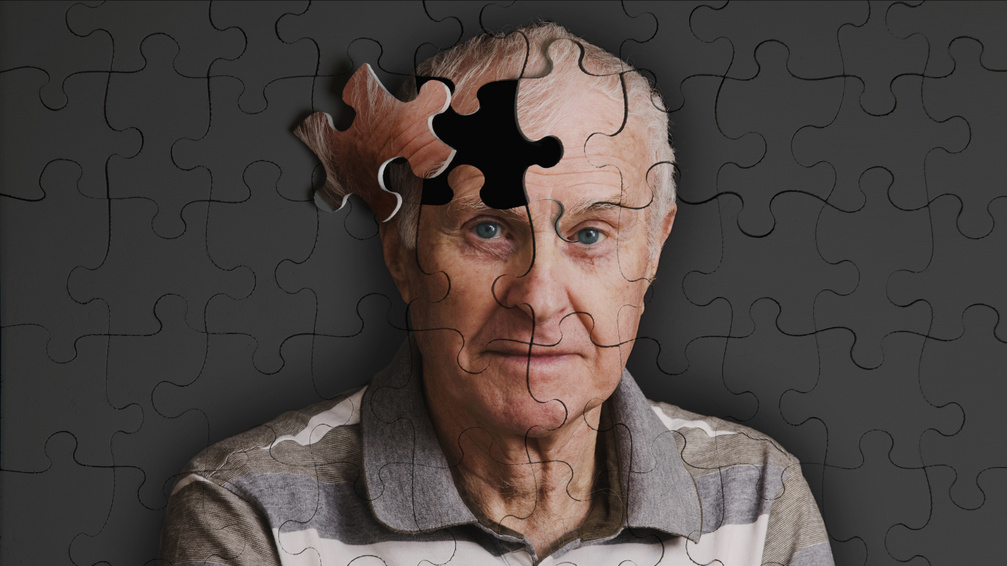 Friss kutatás: ettől a hétköznapi szokástól zsugorodik az agyunk és nő az Alzheimer-kockázata