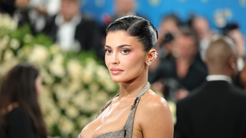 Kylie Jenner mellnagyobbítása  lavinát indított el – az orvos is megszólalt