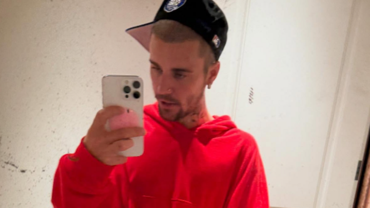 Egyre aggasztóbb Justin Bieber állapota, sokan már lemondtak róla