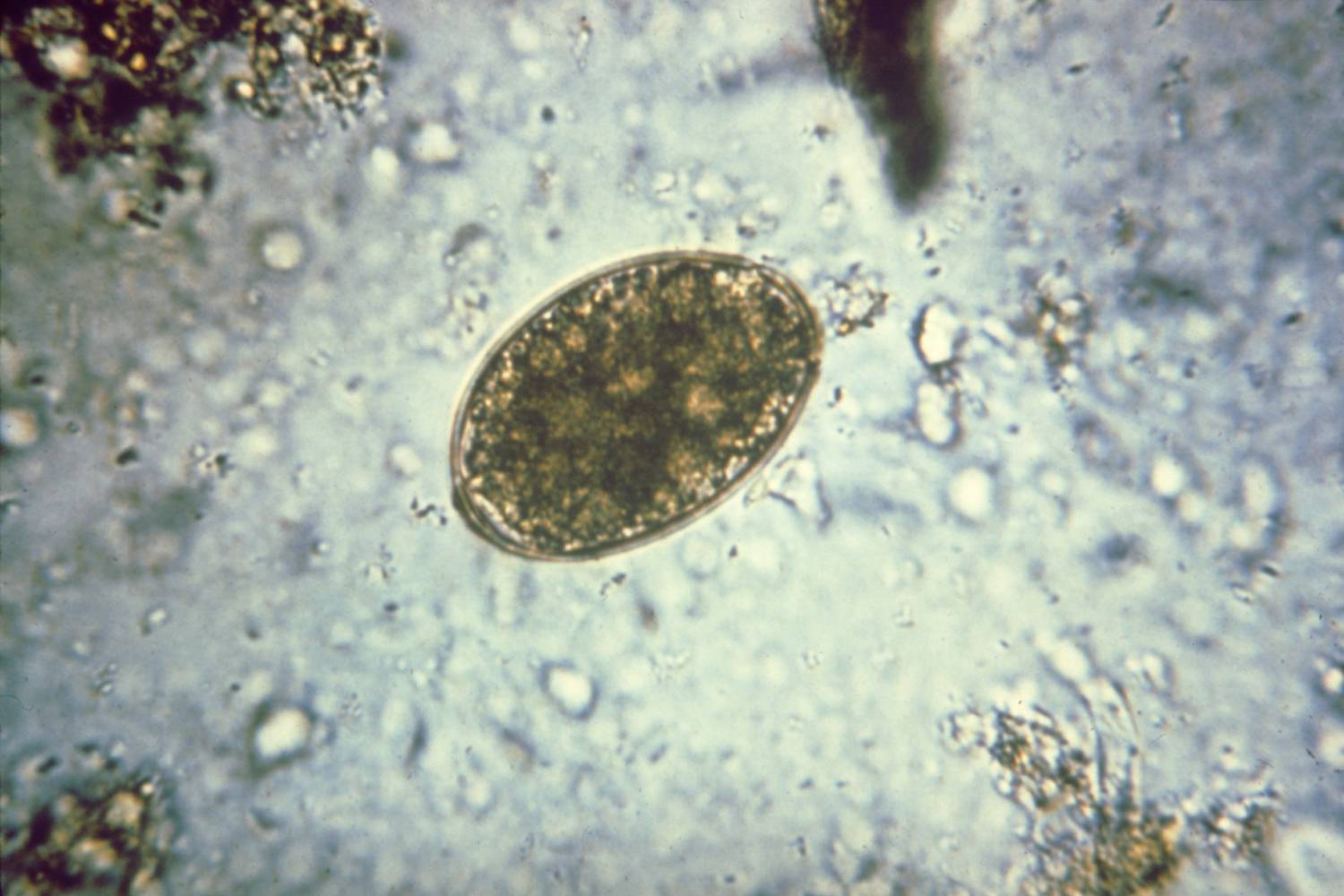 Így néz ki a galandférgek egyik típusának (Diphyllobothrium latum) a tojása.
