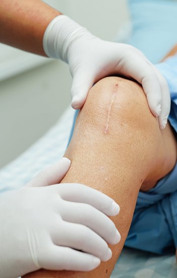 Nem csökkennek a várólisták, sőt – Mutatjuk a friss számokat