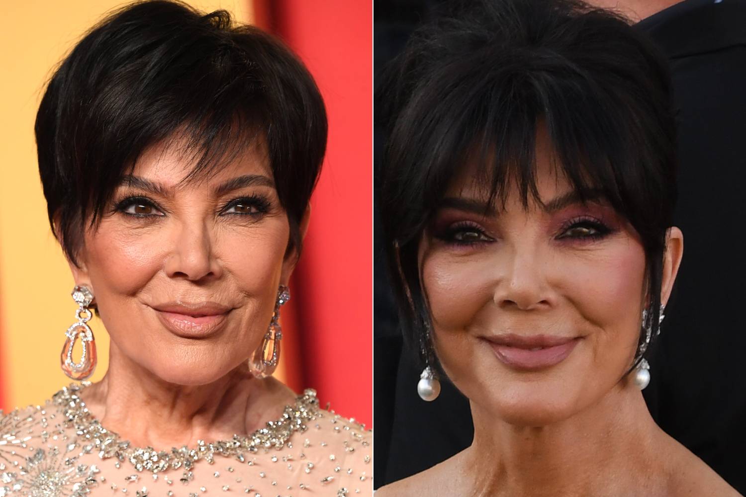Kris Jenner 2024-ben az Oscar-gála afterpartiján és idén, Jeff Bezosék esküvőjén. Sokkal kisimultabb az arca, de még a nyaka is.