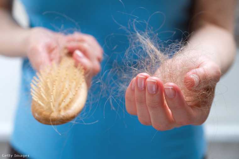 A Mounjaro egre több használója tapasztal hajhullást. (Illusztráció: Getty Images)
