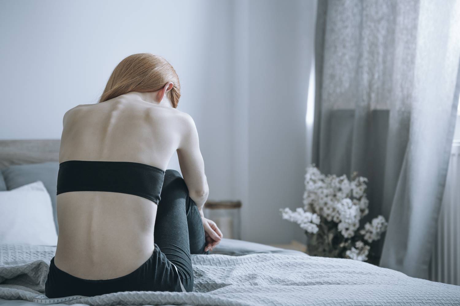 anorexia-vekony-no