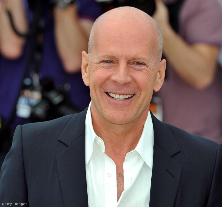 Bruce Willis&nbsp;2022-ben afáziát diagnosztizáltak nála, majd 2023-ban a család bejelentette: frontotemporális demenciával küzd