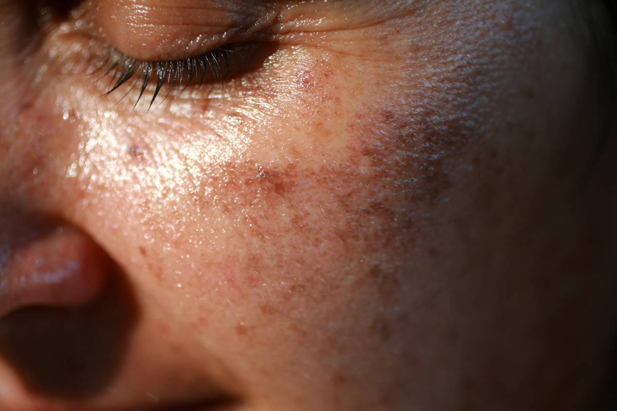 Kép: Getty Images.