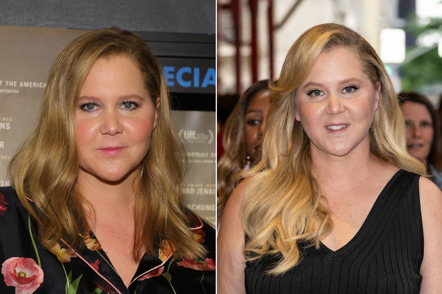 Amy Schumer azon kevés sztárok egyike, aki nyíltan vállalja, hogy Ozempiccel, majd Mounjaro injekcióval fogyott.