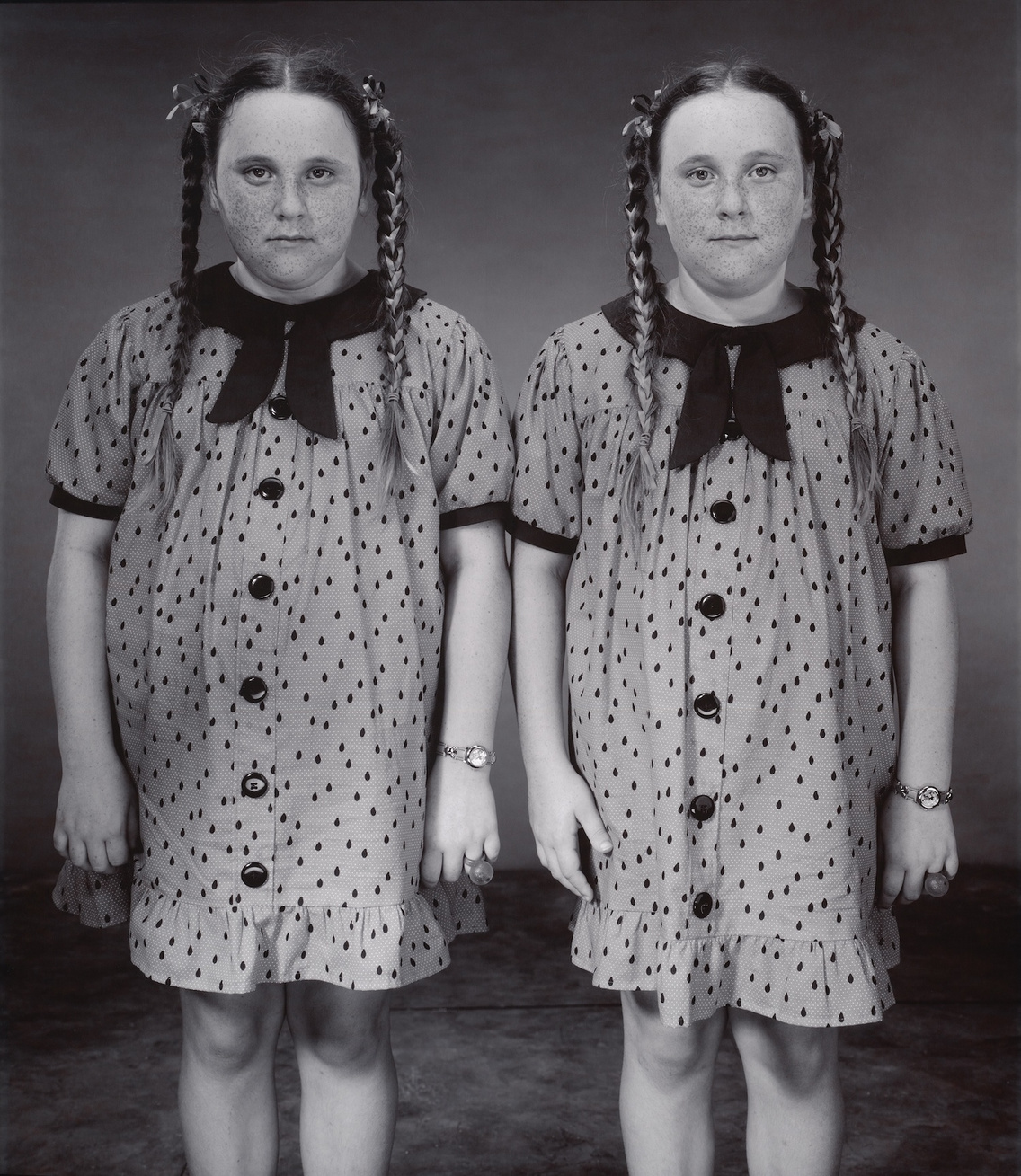 Cayla és Mylee Simmermon, 10 évesek (Mylee 2 perccel idősebb), Ikrek Fesztivál, Twinsburg, Ohio, USA, 2001
