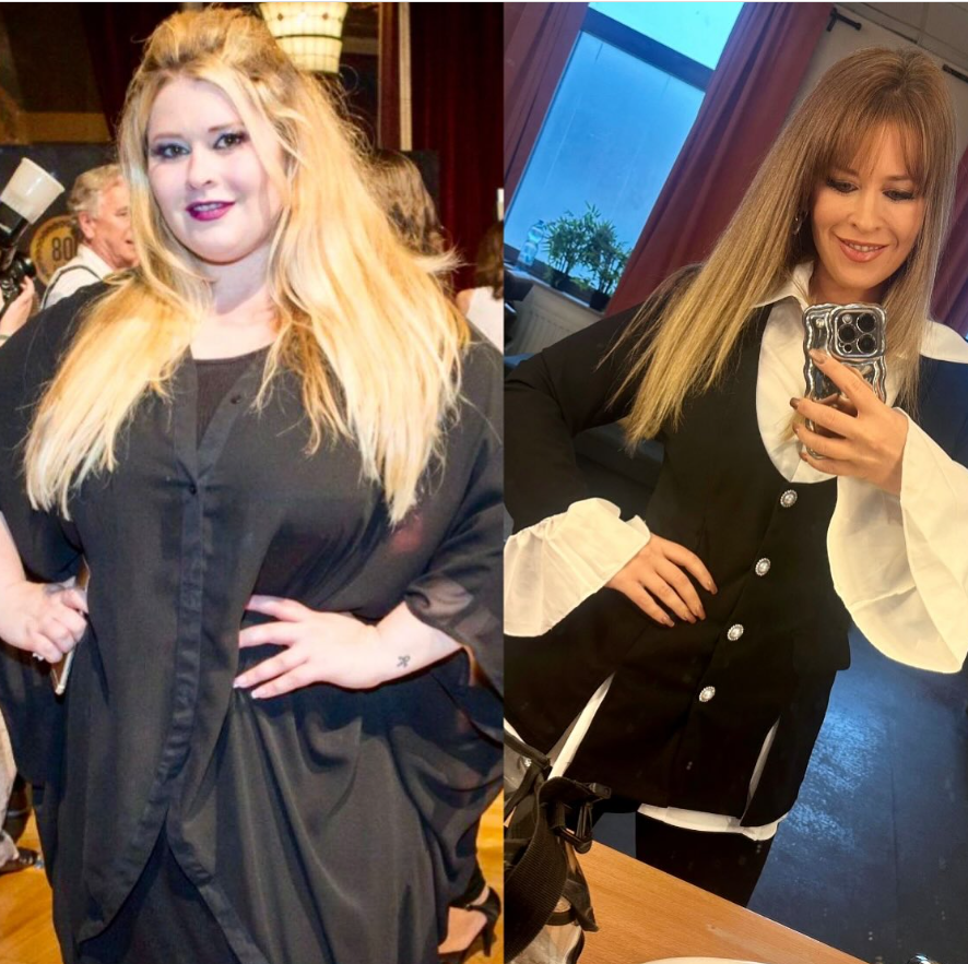 Király Linda éveken át küzdött a plusz kilókkal, mígnem életmódot váltott és egyre karcsúbb és karcsúbb lett. Mára teljesen megváltozott nemcsak a külseje, de a kisugárzása is.