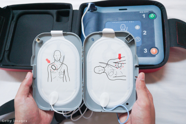 Fontosabb a defibrillátor épsége, mint az ember? - Dívány