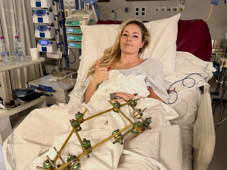 Lindsey Vonn a kórházi ágyán fekszik Trevisóban 2026. február 11-én