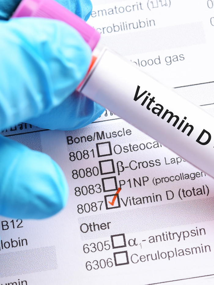 A gyógyszerész figyelmeztet, erre ügyeljen nagyon mindenki,  aki D-vitamint szed