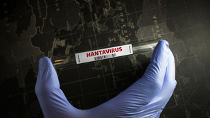 A hantavírus lehet az új COVID?