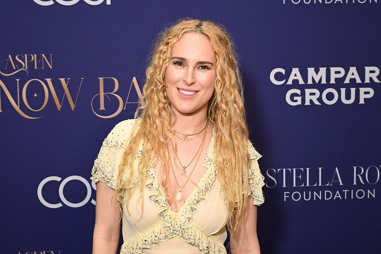Rumer WillisDemi Moore lánya, Rumer Willis állítólag édesanyja nyomdokaiba lépett a plasztikai beavatkozások terén