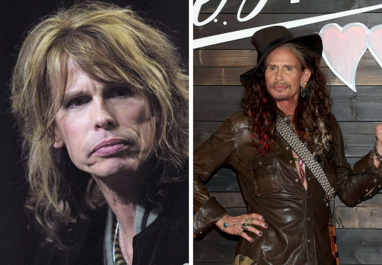 Steven Tyler&nbsp;Steven Tyler 2011-ben paraguayi turnéja során elesett a zuhanyzóban, felsértette az arcát, és az egyik foga is kitört