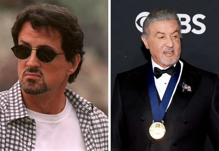 Sylvester Stallone&nbsp;Sylvester Stallone arcának egyik oldala születésekor sérült meg, ami részleges bénulást okozott