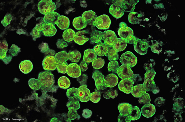Naegleria fowleri
