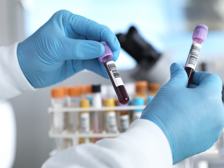 CRP: gyorsan reagálhat a gyulladásraA CRP, vagyis C-reaktív protein a májban termelődő fehérje