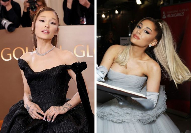 Ariana GrandeAriana Grande külsejének változása már évek óta rendszeresen témát szolgáltat az interneten, az énekesnő azonban azon kevés világsztárok közé tartozik, akik maguk is nyíltan beszéltek korábbi esztétikai kezeléseikről