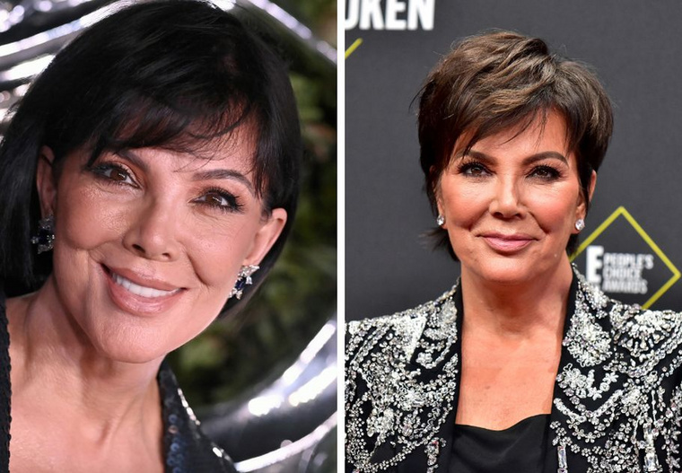 Kris JennerKris Jenner esetében nincs szükség találgatásokra