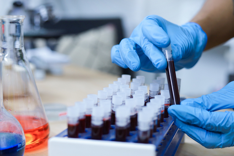 Vércukor, HbA1c és vesefunkcióA laborvizsgálatok természetesen továbbra is a gondozás fontos részét jelentik