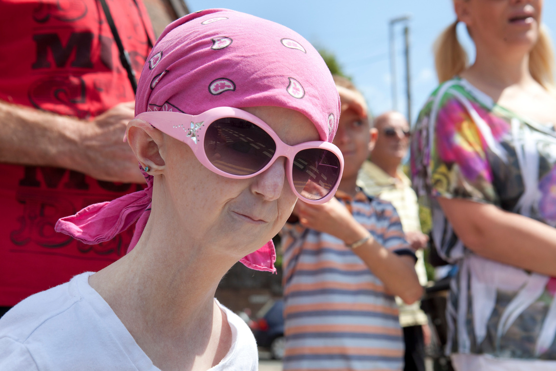 Астемир шериев прогерия. Хейли окинс. Хейли окинс. Прогерия (синдром хатчинсона–гилфорда). Хейли окинс.