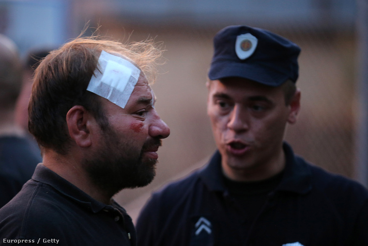 Szerb rendőr egy menekült férfival, aki a tegnapi összecsapások során sérült meg a szerb-magyar határon.